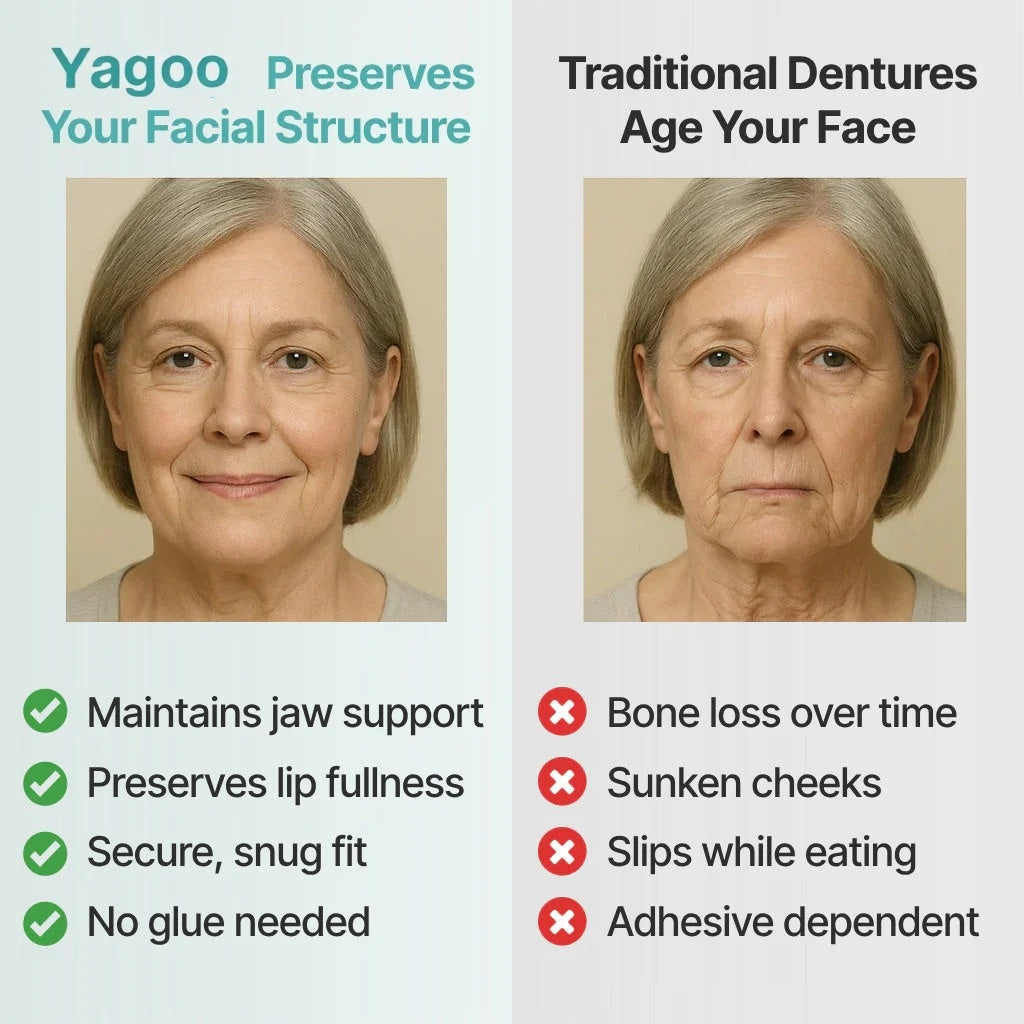 🦷Ends Today: 70% OFF! ⏰Yagoo™ Medical Full Denture with Strong Suctiond🌎Obtain American Dental Association (ADA) Certification