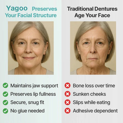 🦷Ends Today: 70% OFF! ⏰Yagoo™ Medical Full Denture with Strong Suctiond🌎Obtain American Dental Association (ADA) Certification